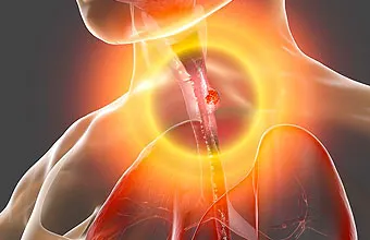 oesophage